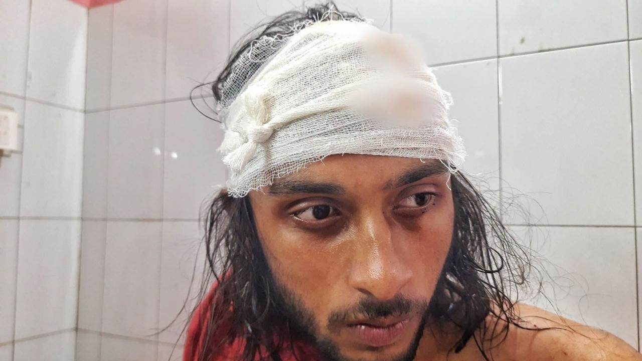 নজরুল বিশ্ববিদ্যালয়ে ছাত্রদলের সংঘর্ষ, শিক্ষার্থীকে হাতুড়িপেটা