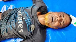সাতক্ষীরার শ্যামনগরে বজ্রপাতে কৃষকের মৃত্যু