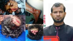 বরগুনায় চাঁদা না পেয়ে ভেকু চালককে কুপিয়ে জখম