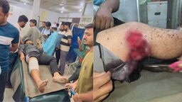 নোয়াখালীর বেগমগঞ্জে নিজ বাড়ির সামনে গুলিবিদ্ধ জামায়াত কর্মী