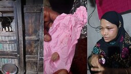 চুরি করতে এসে গৃহবধূর কামড়ে আঙুল হারাল চোর, তবু মোবাইল নিয়ে পালালো
