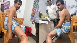 মাটি কাটার প্রতিবাদ করায় বিএনপি নেতার ওপর হামলা, থানায় মামলা