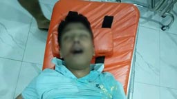 মাদকাসক্ত ব্যক্তির হামলায় আহত রবীন্দ্র বিশ্ববিদ্যালয়ের শিক্ষার্থী