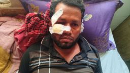 গোপালগঞ্জ সম্পত্তি বিরোধে দুই ভাইয়ের সংঘর্ষে ছোট ভাই আহত