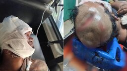 নোয়াখালীতে জমি বিরোধের জেরে কুপিয়ে জখম, বৃদ্ধের মৃত্যু