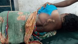 কোটালীপাড়ায় বজ্রপাতে দুই নারী গুরুতর আহত, ৩টি গৃহপালিত পশুর মৃত্যু