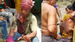নবীনগরে পূর্ব শত্রুতার জেরে দুই পক্ষের রক্তক্ষয়ী সংঘর্ষ, আহত ১১