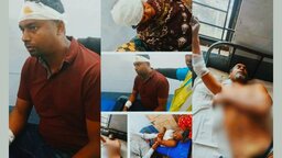 শৈলকুপায় আধিপত্য বিস্তার নিয়ে রক্তক্ষয়ী সংঘর্ষ, পুলিশসহ আহত ৭