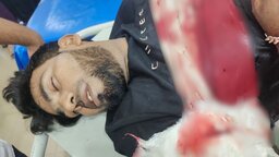 নোয়াখালীতে চাঁদা না পেয়ে প্রবাসীর হাতের কবজি কাটলো সন্ত্রাসীরা
