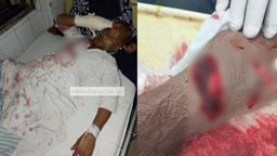 কোরবানির হাটে চাঁদা না দেওয়ায় বিএনপির পাতি নেতার ছুরিকাঘাতে বৃদ্ধ আহত!
