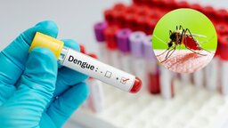 ৭০ হাজার ছাড়িয়েছে ডেঙ্গুতে আক্রান্ত রোগীর সংখ্যা