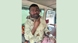 যশোরের শার্শায় ককটেল বিস্ফোরণে ২ শ্রমিক আহত