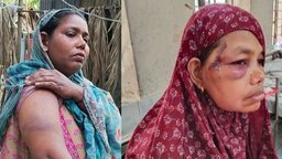 দাঁড়িপাল্লায় ভোট দেওয়াকে কেন্দ্র করে রাজাপুরে তিন নারীকে পিটিয়ে জখম