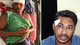 শিবচরে জমি নিয়ে পুর্ব শত্রুতার জেরে সংঘর্ষঃ হতাহত ৪