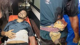 বেগমগঞ্জে মুখোশ পরে দোকানে ঢুকে ব্যবসায়ীকে গুলি