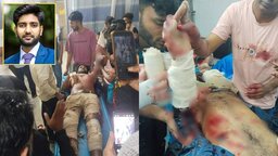 বাকেরগঞ্জে ছাত্রদল নেতাকে কুপিয়ে জখম, গ্রেফতার ১