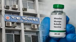 হাম ও হামের উপসর্গ নিয়ে গত ২৪ ঘণ্টায় ১০ শিশুর মৃত্যু