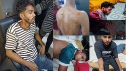 নোয়াখালীতে গায়ে হলুদের অনুষ্ঠানে যাওয়ার পথে গুলিবিদ্ধ ৫