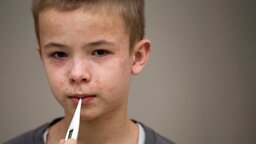 ফরিদপুরে হামের প্রাদুর্ভাব : ২৪ ঘণ্টায় শনাক্ত ৩৩, মোট আক্রান্ত ৫০০ ছাড়াল