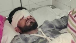 চাঁদাবাজির প্রতিবাদ করায় যুবদল নেতার ওপর ছাত্রদল নেতার হামলা