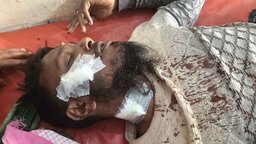 মহিপুরে স্বেচ্ছাসেবক দল নেতাকে কুপিয়ে জখম